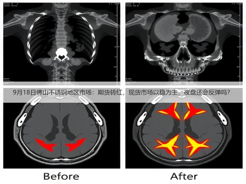 9月18日佛山不锈钢地区市场：期货转红，现货市场以稳为主，夜盘还会反弹吗？