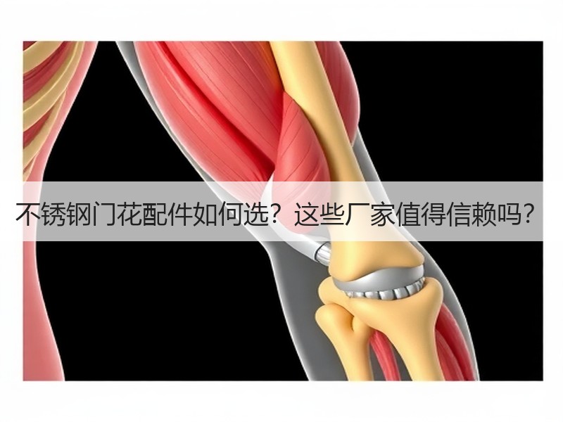 不锈钢门花配件如何选？这些厂家值得信赖吗？